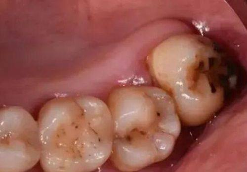 周念医生擅长项目