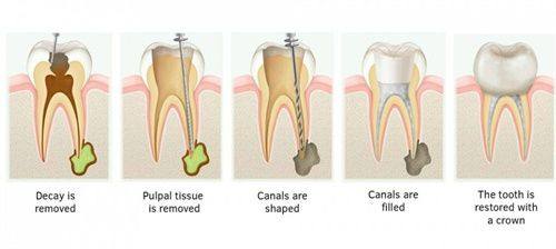 陕西咸阳爱牙仕口腔门诊部详细的预约挂号方式及流程