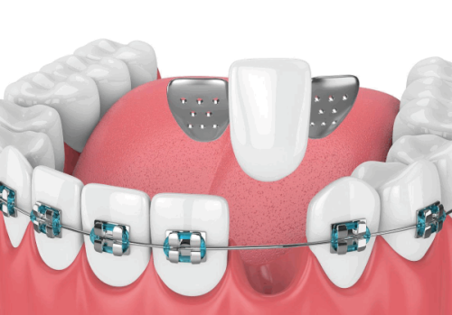 伊静医生擅长项目