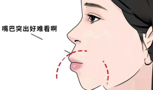 王淼医生擅长项目