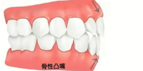 周念医生技术优势