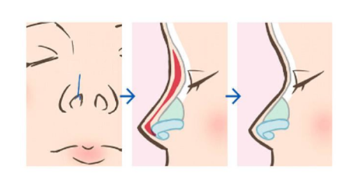 阜阳朱家富整形医院特色项目及技术优势