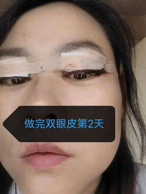 杭州医巢医疗美容诊所真人口碑评价怎么样？