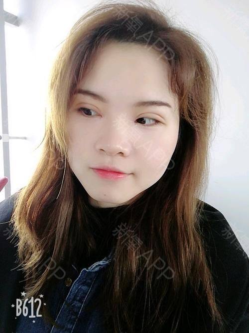 宁波江北建国整形医院是正规医院吗？