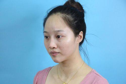 田永华医生技术优势