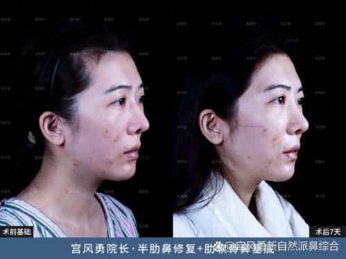 田永华医生坐诊医院