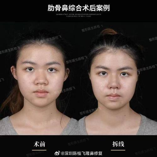 宁波江北建国整形医院医生团队实力强大及骨干医生简介