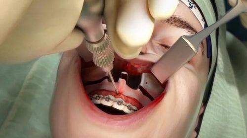 韩相百医生技术优势