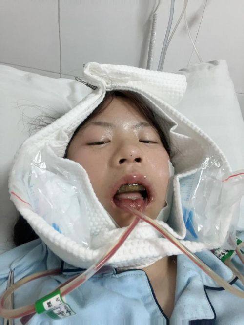 韩相百医生口碑评价及真人实例