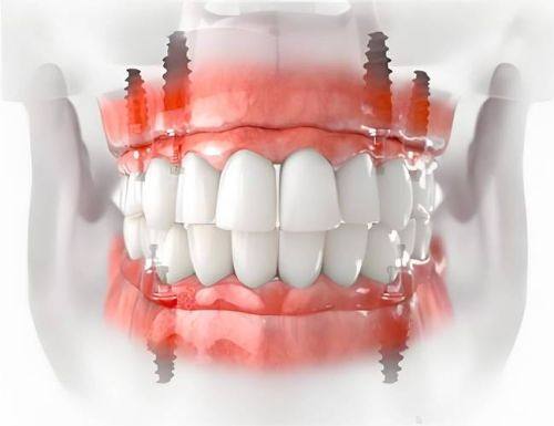 银川市第一人民医院口腔科详细的预约挂号方式及流程