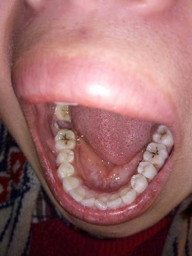 宁波北仑袁惠玲口腔诊所收费价格表/收费标准