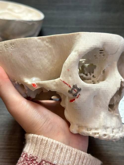 医生口碑评价及真人实例