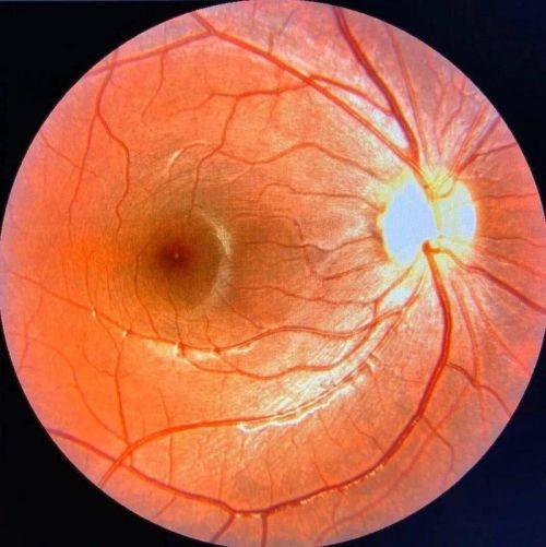 黑龙江省哈尔滨云海眼科医院真人口碑评价怎么样？