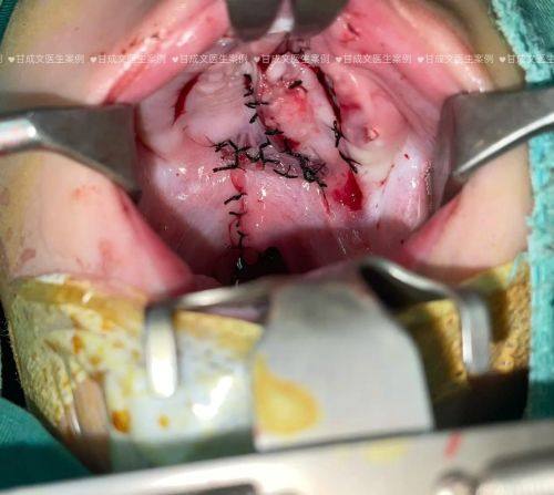 上海海军四一一医院激光整形美容中 心详细的预约挂号方式及流程