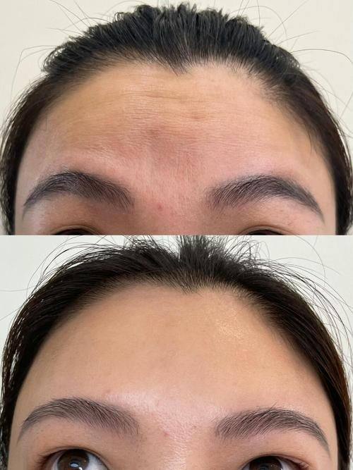 广州南珠医疗美容门诊部详细的预约挂号方式及流程