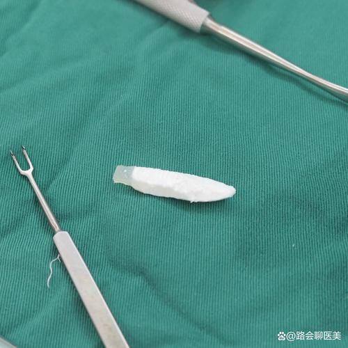 宁波江北建国整形医院详细的预约挂号方式及流程