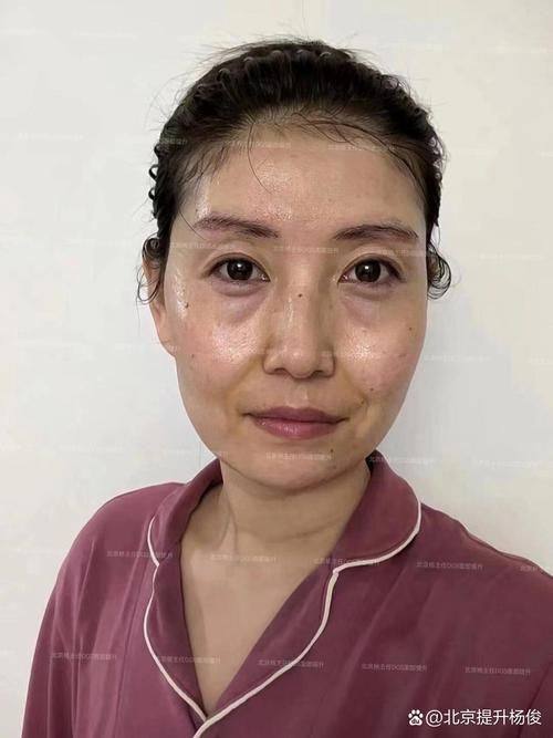 广州南珠医疗美容门诊部是正规医院吗？