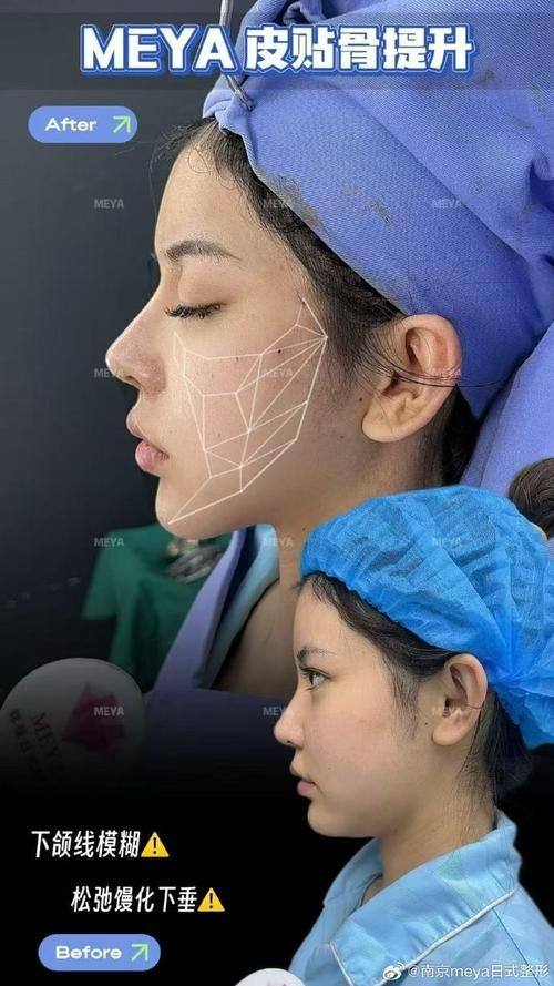 天津丽滋卡尔医院整形美容中 心特色项目及技术优势