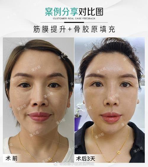 天津丽滋卡尔医院整形美容中 心真人口碑评价怎么样？