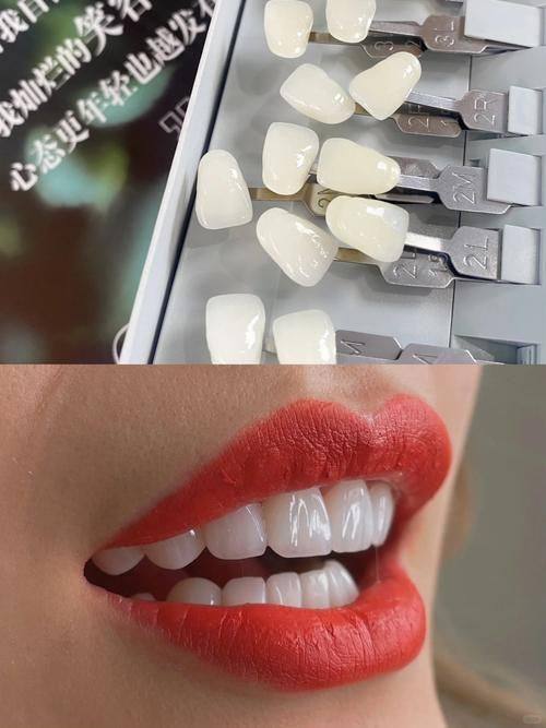 宁波北仑袁惠玲口腔诊所特色项目及技术优势