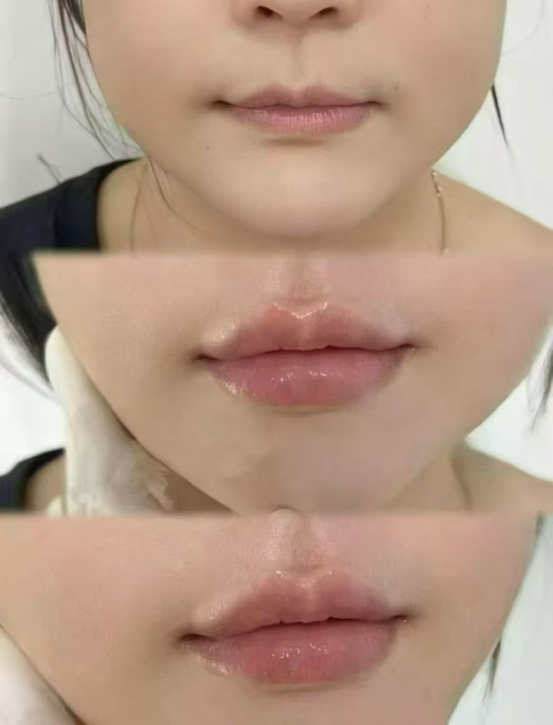 吴亮医生口碑评价及真人实例