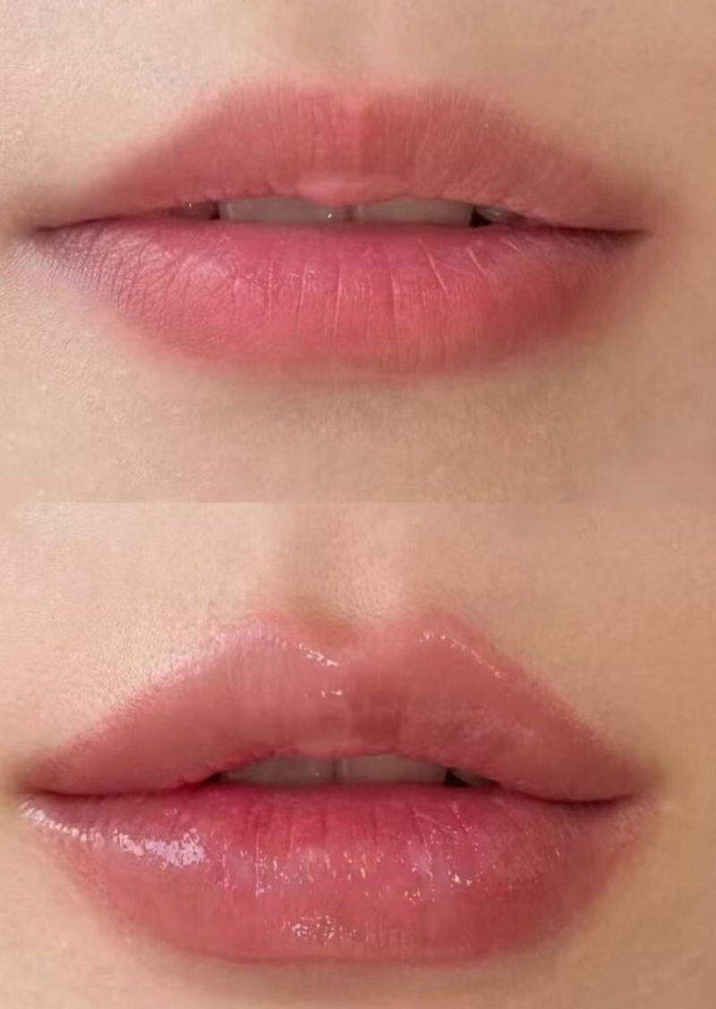 上海海军四一一医院激光整形美容中 心收费价格表/收费标准