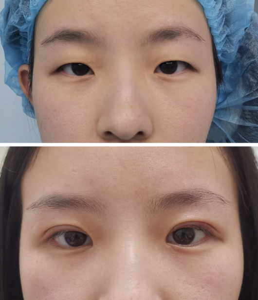 田永华医生口碑评价及真人实例