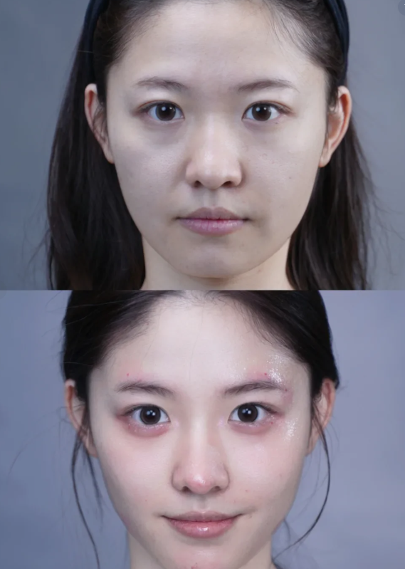 吴亮医生预约挂号