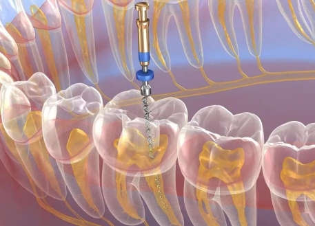 伊静医生口碑评价及真人实例