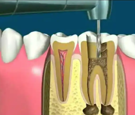 十堰美盛口腔门诊部收费价格表/收费标准