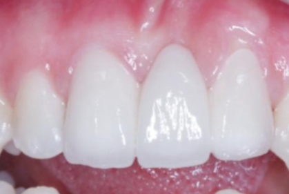 伊静医生价格表