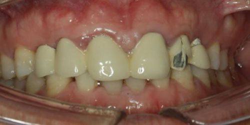 陶胤彤医生擅长项目