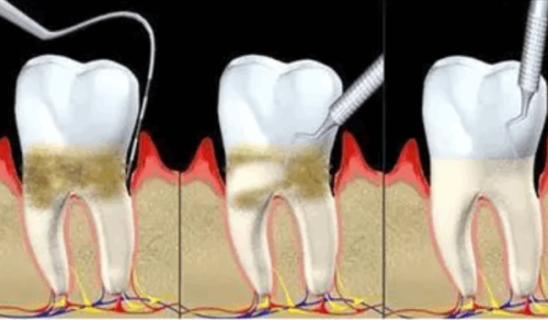 周念医生价格表