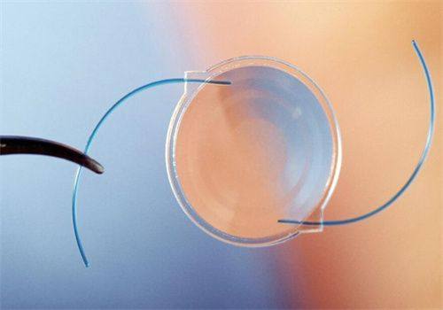 王晓艳医生口碑评价及真人实例