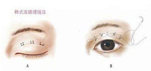 广州健康医然医疗美容门诊部特色项目及技术优势