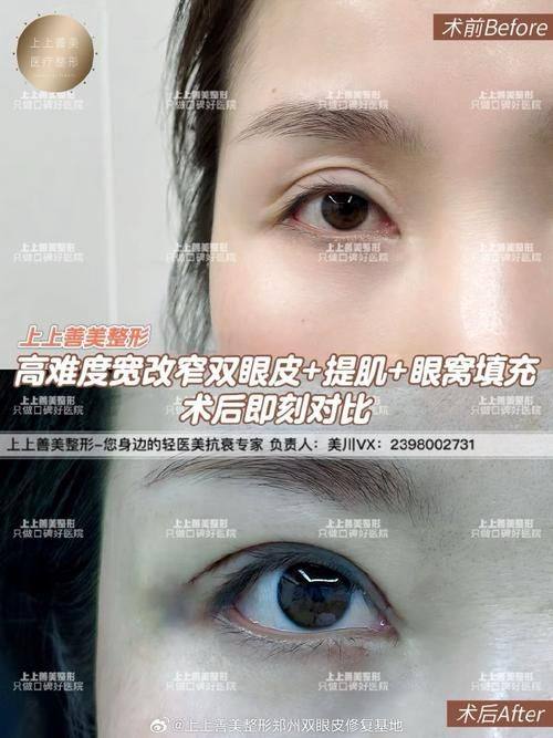 申琦医生擅长项目