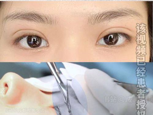 金华东阳丽莱医疗整形美容收费价格表/收费标准