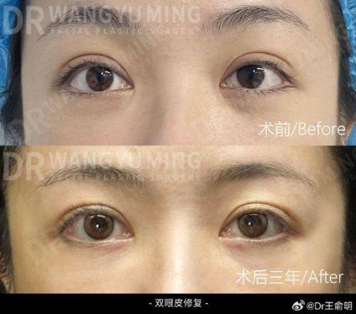 维西森茉整形医院是正规医院吗？