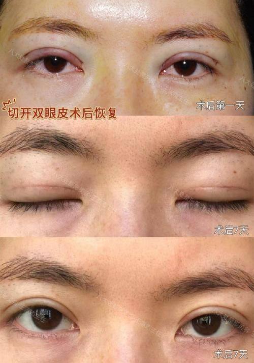 金华东阳丽莱医疗整形美容是正规医院吗？