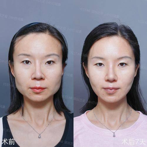 天津雅韵医疗美容门诊收费价格表/收费标准