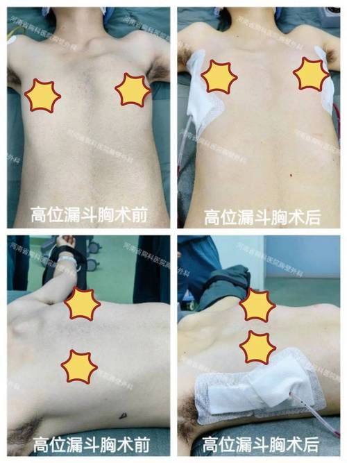 黄文博医生技术优势