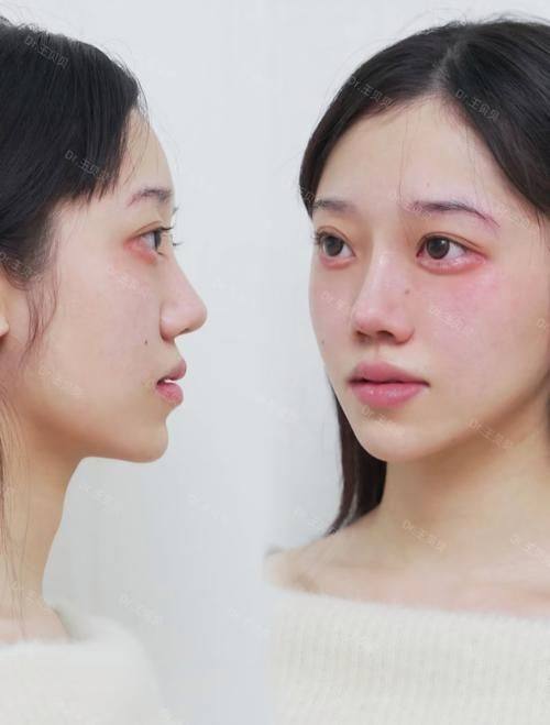 维西森茉整形医院详细的预约挂号方式及流程