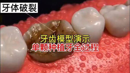 口碑评价及真人实例