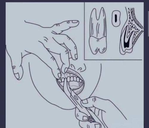 牙博士口腔医院（江北院）真人口碑评价怎么样？