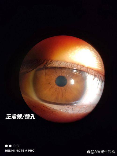 中南大学湘雅医院眼科是正规医院吗？