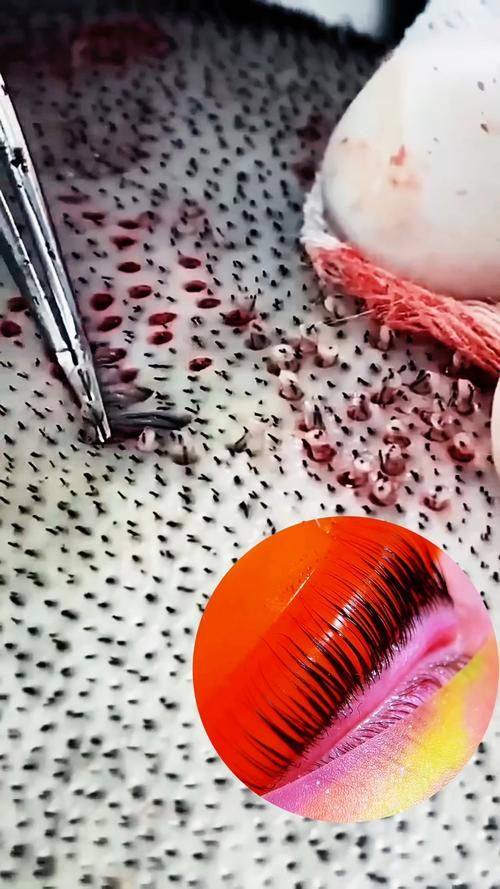 常德丝宿植发医疗美容门诊部详细的预约挂号方式及流程