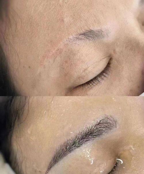 常德丝宿植发医疗美容门诊部收费价格表/收费标准