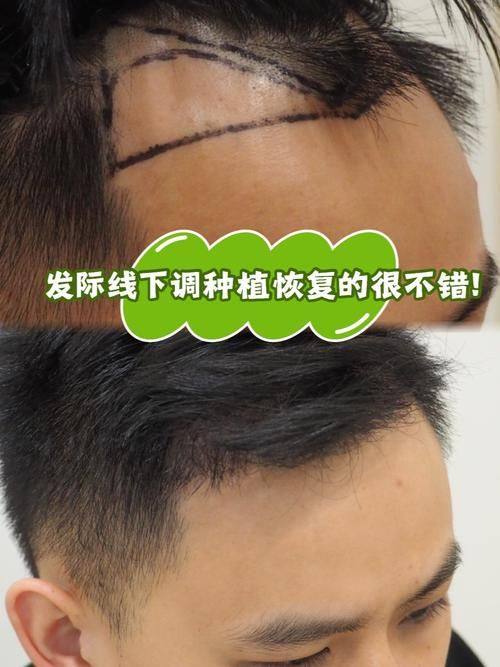 常德丝宿植发医疗美容门诊部是正规医院吗？