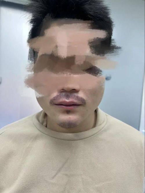 常德丝宿植发医疗美容门诊部真人口碑评价怎么样？