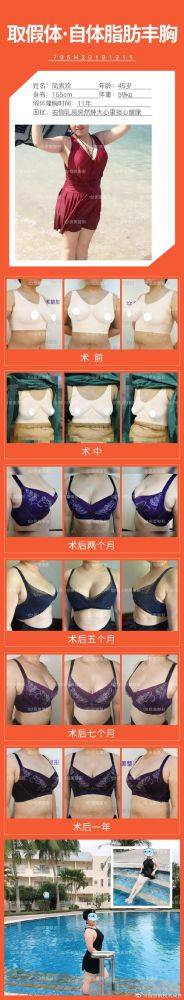 天津雅韵医疗美容门诊特色项目及技术优势